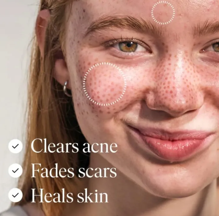 Arfa%20Cosmetics%20Pack%20OF%203%20Facial%20Drops%20with%20Vitamins,%20Minerals%20&%20Fruit%20Extracts%20Urgent%20Whitening%20Skin%20Brightening%20Orange%20Facial%20Drop%20All%20Skin%20Types%20Use%20-%20Image%205