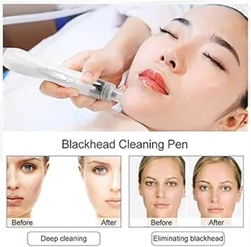 Hydra%20Facial%20Machine%20Professional%20H202%207%20in1%20-%20Image%205