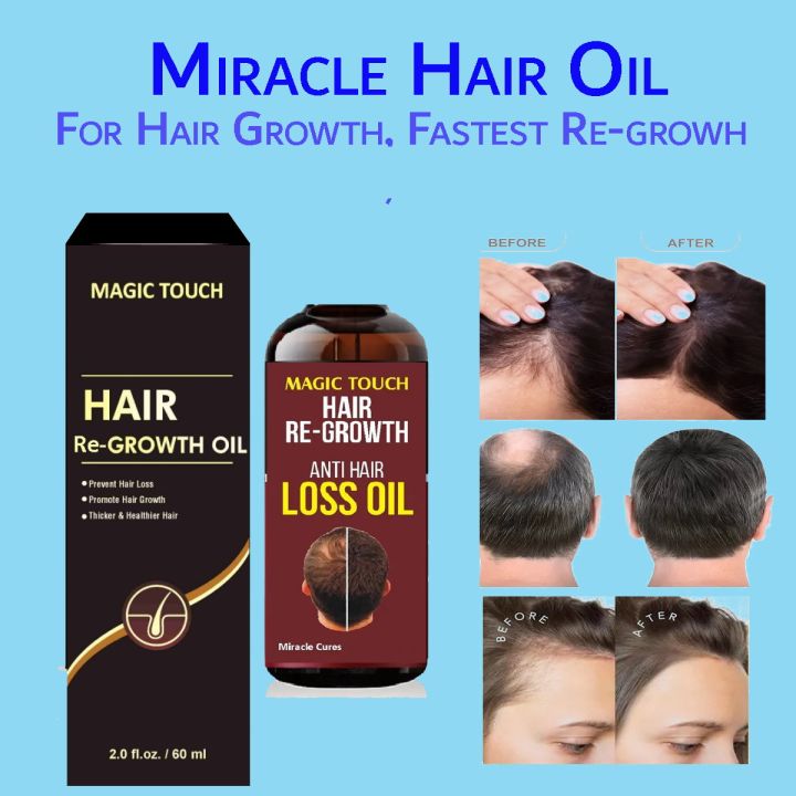 Miracle Hair Oil - Magic Touch Organic Herbal Formula for Hair Growth & Regrowth (60ml) For Men & Women | Stops Hair Fall | Promotes Thick, Long & Healthy Hair