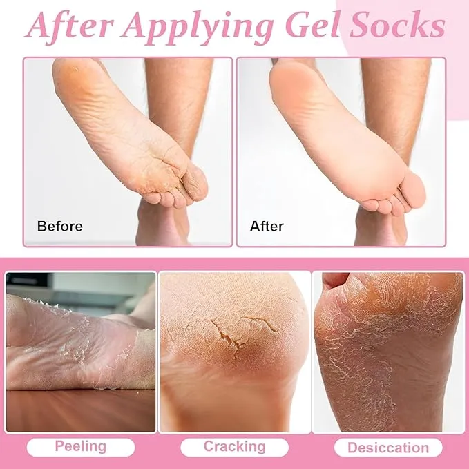 FRAKIN%201-Pair%20Silicone%20Moisturizing%20Socks,%20Soft%20Silicone%20Socks%20For%20Cracked%20Feet%20Women%20And%20Men%20Foot%20Moisturiser%20Socks%20Foot%20Spa%20Pedicure%20Silicone%20Gel%20Socks%20For%20Cracked%20Feet%20Dry%20Skins%20Calluses%20-%20Image%207