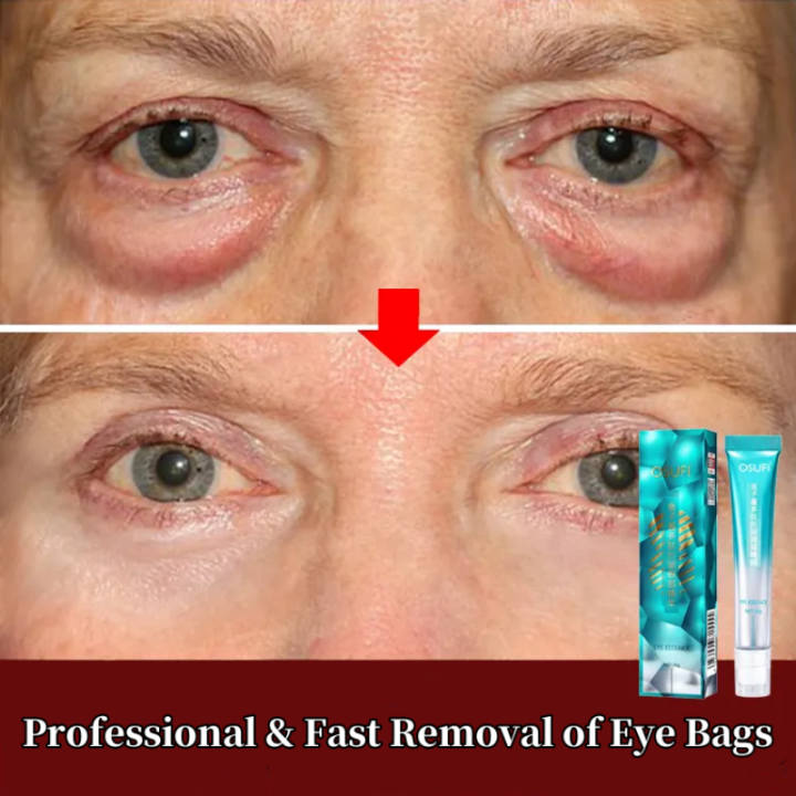 Killer Bzzo 7 Days Anti-Wrinkle Magic Eye Cream Remove Eye Bags Dark Circles Puffiness Lift Firm Smooth Skin Care Moisturizing Massage Serum