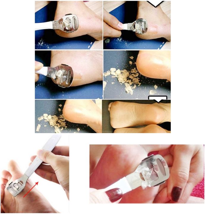 Foot%20Feet%20Ankle%20Dead%20Skin%20Remover%20Scraper%20Callus%20Remover%20Manicure%20pedicure%20Beauty%20Tool%20Gadget%20-%20Image%204