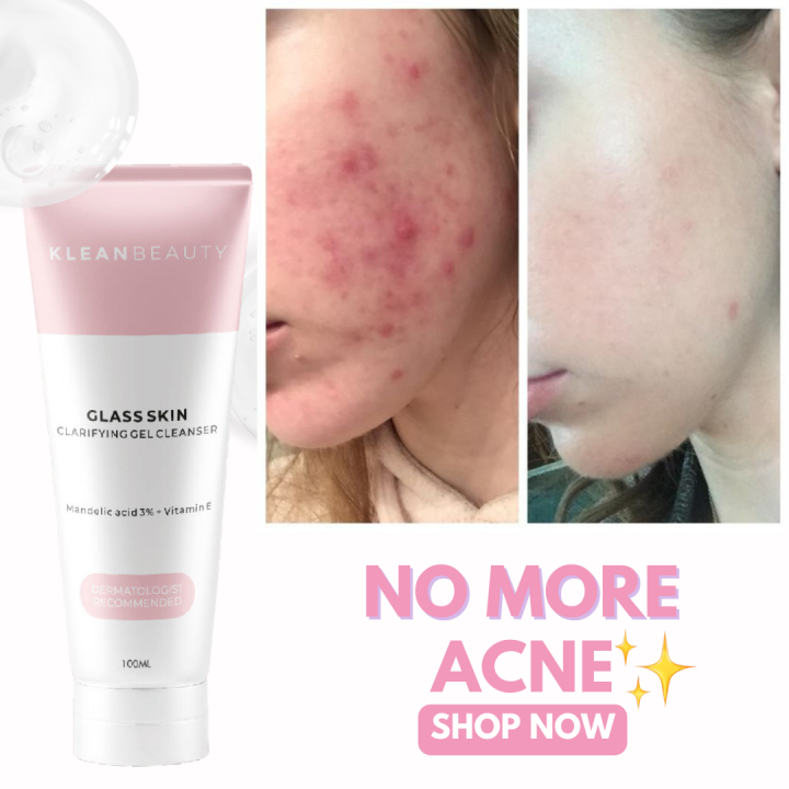 Klean%20Beauty%20Clarifying%20Gel%20Facewash%20100ml%20/%2050ml%20Korean%20glass%20skin%20%7C%20deeply%20cleanses%20pores%20%7C%20controls%20oil%20%7C%20reduces%20wrinkles%20%7C%20dark%20circles%20%7C%20acne%20scars%20%7C%20brightens%20%7C%20%20rejuvenates%20%7C%20radiant%20%7C%20glass-skin%20glow%20%7C%20Perfect%20for%20all%20skin%20types%20-%20Image%204