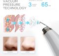 Original 6 in 1 Multi-Functional Blackheads Removal Machine Rechargeable Blackhead Remover Vacuum Acne Pimple Remover Black Spot Suction Electric Facial Pore Cleaner Skincare Exfoliating Beauty Device. 