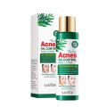 Sadoer Acnes Tea Tree Anti Wrinkle Oil Control Moisturizing & Nourishing Face Lotion 120ml. 