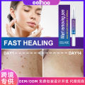Wart Removal Pen – Liquid Treatment for Hand & Foot Warts. 