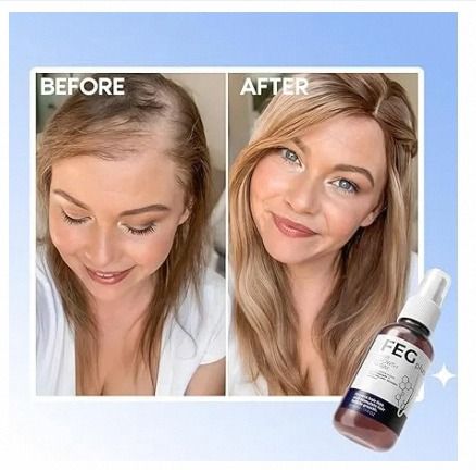 FEGPLUS%20Hair%20Growth%20Serum%20%E2%80%93%2022%25%20Seaweed%20Extract%20%7C%20Fast%20Regrowth,%20Anti-Baldness%20&%20Thicker%20Hair%20for%20Men%20&%20Women%20(50ml)%20-%20Image%203