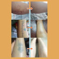 Silicone Tattoo Conceal Tape Full Cover Waterproof Covering Patch for Tattoo and Scar. 