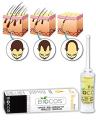 Hair Growth No More Hair Loss & Repair Serum Essential Oil Hair Growth Hair Loss Treatment Hair Growth Serum for Men and Women. 