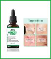Arfa Cosmetics Salicylic Acid Anti Acne Serum with Salicylic Acid Oil Control and Acne Removal Acne Skin Care Products All Skin Types Use 30Ml. 