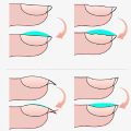 MSHARE Reinforcement Gel Self Leveling Build Nail Apex C-Curve Builder Strengthen Alignment Base Top Soak Off 10ml in bottle. 