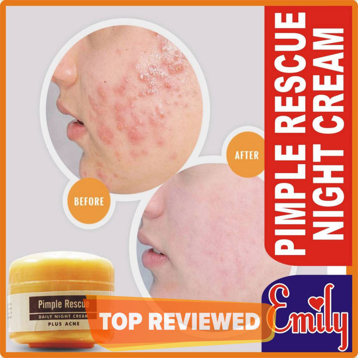 Pimple%20Rescue%20Daily%20Night%20Cream%20AntiAcne%20&%20Anti%20Pimple%20Cream%20(4%20DAYS%20EFFECTIVE)%2025g%20-%20Image%203