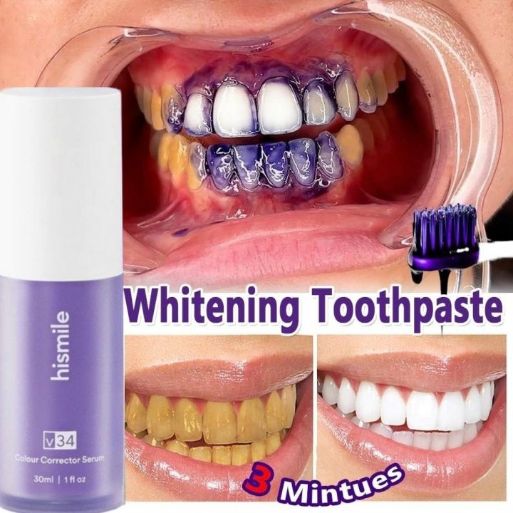HISMILE%20V34%20Teeth%20Removing%20Deep%20Smoke%20Stains%20Gingiva%20Protection%20Purple%20Orthopedic%20Toothpaste,%20Purple%20Teeth%20Whitening%20Toothpaste%20Kit%20-%20Image%203