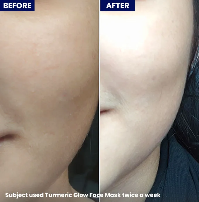 Jenpharm%20-%20Turmeric%20Glow%20Face%20Mask%20%E2%80%93%20Brightening%20Clay%20Mask%20for%20Glowing%20Skin%20%7C%20Turmeric,%20Saffron%20&%20Aloe%20Vera%20%7C%20Dark%20Spots%20&%20Dull%20Skin%20Treatment%20-%20Image%206