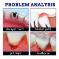 Tooth Pain Relief Spray Teeth Decay Remover Periodontitis Cleaner Treatment swelling gums Toothache inflammation dental caries. 