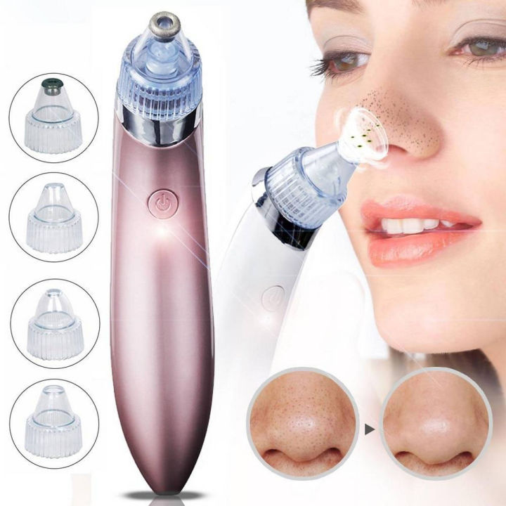 Black Head Remover Machine XN 8030 Rechargeable Pore Cleaner Vacuum Negative Pressure Acne Pore Cleanser 4 Changeable Head