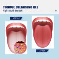 EELHOE 50g Tongue Cleaning Gel with Brush Oral Care Removal Odor Health Fresh Breath Dental Hygiene Care Coating Cleaning Kit. 