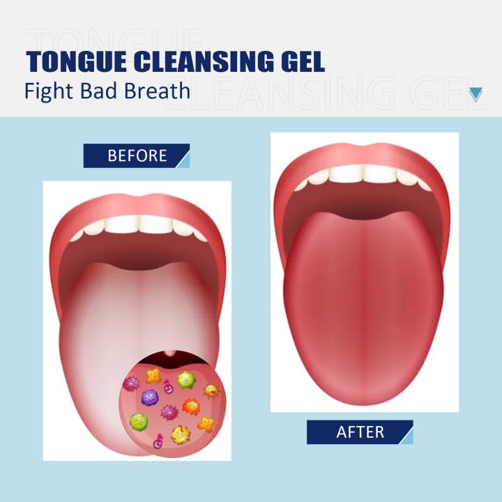EELHOE%2050g%20Tongue%20Cleaning%20Gel%20with%20Brush%20Oral%20Care%20Removal%20Odor%20Health%20Fresh%20Breath%20Dental%20Hygiene%20Care%20Coating%20Cleaning%20Kit%20-%20Image%204