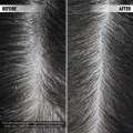 DUOLOGI Anti Flake Purifying Shampoo Anti Dandruff Shampoo 250ml Skin Care for your Hair. 