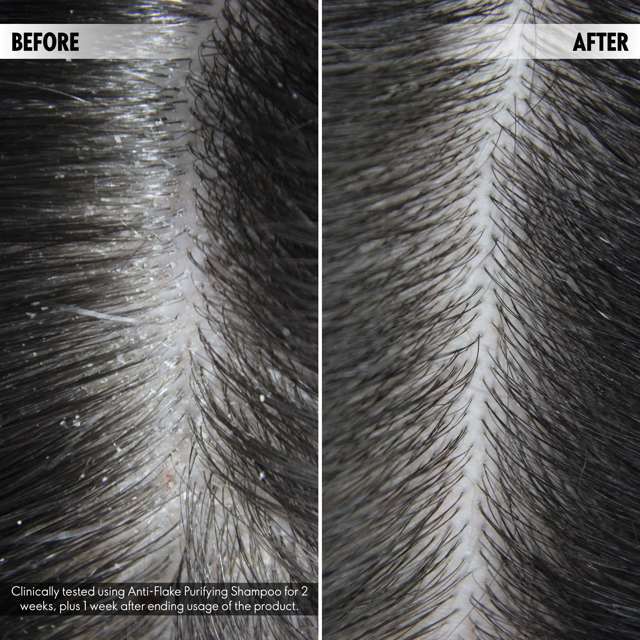DUOLOGI%20Anti%20Flake%20Purifying%20Shampoo%20Anti%20Dandruff%20Shampoo%20250ml%20Skin%20Care%20for%20your%20Hair%20-%20Image%203