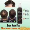 Magic Touch Hair Oil for All Hair Care | Hair Regrowth Formula | Repair Damaged Hair | Anti Hair Loss | Fast Hair Growth 150ml. 