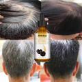 New Repair Damage Anti-Hair Sercum Gray Hair Care Serum Ebony Hair Nourishing Hair Loss Men And Women Fast Lasting Beauty Health Feeoi Freeio. 