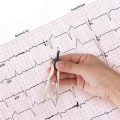 EKG Calipers ECG Caliper Measuring Tool with Ruler Black Caliper Divider for Nurse or Doctor. 