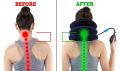 Physiotherapy cervical Traction Kit/Collar. 