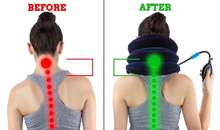 Physiotherapy cervical Traction Kit/Collar