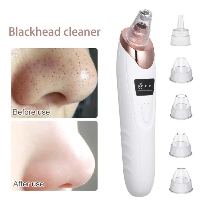 5%20in%201%20Electric%20Blackhead%20Remover%20Vacuum%20%E2%80%93%20Acne%20&%20Pimple%20Suction%20Machine,%20Whitehead%20&%20Oil%20Cleaner,%20Rechargeable%20Pore%20Cleaner%20Device%20-%20Trendiz%20-%20Image%204