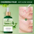 CHARMINGFLOW Anti Acne serum with Salicylic Acid for oil Control and acne removal 30 ml. 