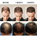 Hair Growth Serum – Anti Hair Fall • Faster Hair Regrowth • Strengthens Roots • Thick, Healthy & Volumized Hair – Herbal Extract Formula – 30ml. 