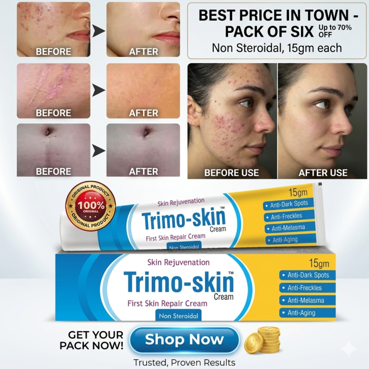 Trimo-skin First Skin Repair Cream, Dark Spot Removal Cream, Anti Freckles Cream, Anti Aging Cream, Skin Repair Cream, New Trimo Skin Cream, Best Skin Repair Treatment, Face Brightening Cream, Elasticity Restoring Cream, Skin Care Products