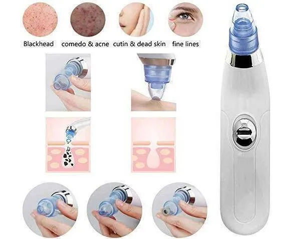 Derma%20Suction%20Pro%204-in-1%20Blackhead%20Remover%20%7C%20Electric%20Pore%20Cleaner%20&%20Acne%20Extractor%20%7C%20Rechargeable%20Facial%20Beauty%20Tool%20-%20Image%203