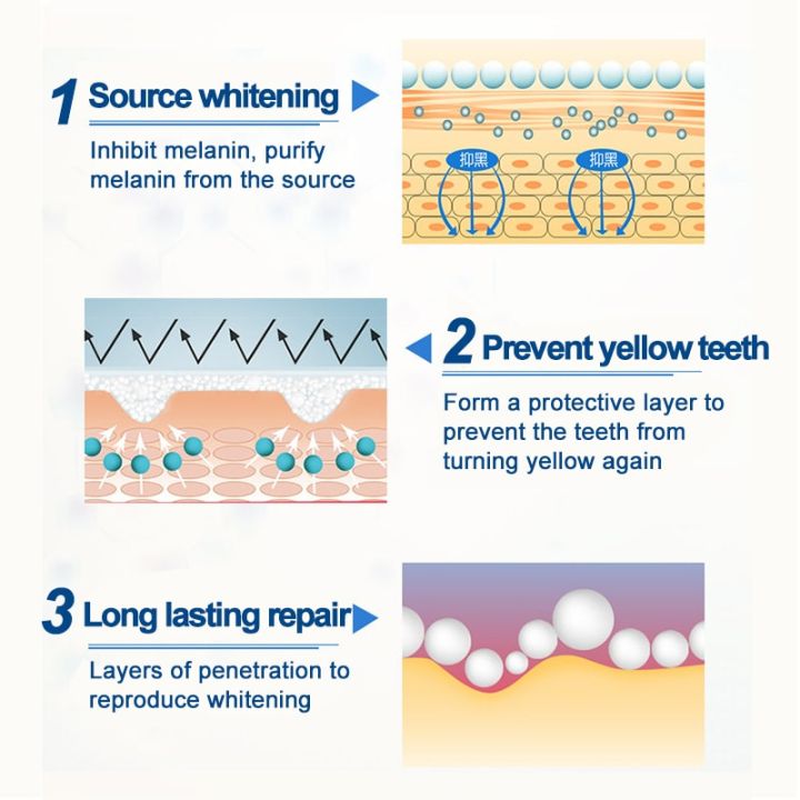 Teeth%20Whitening%20Pen%20For%20Plaque%20And%20Stains%20Removal%20-%20Image%2010