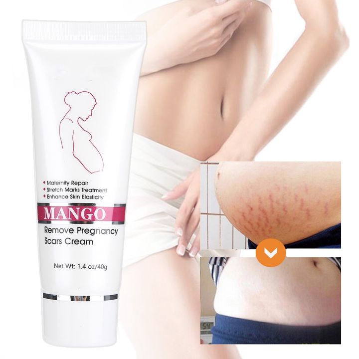 Stretch%20Marks%20Scar%20Removal%20Maternity%20Skin%20Body%20Repair%20Cream%20-%20Image%203