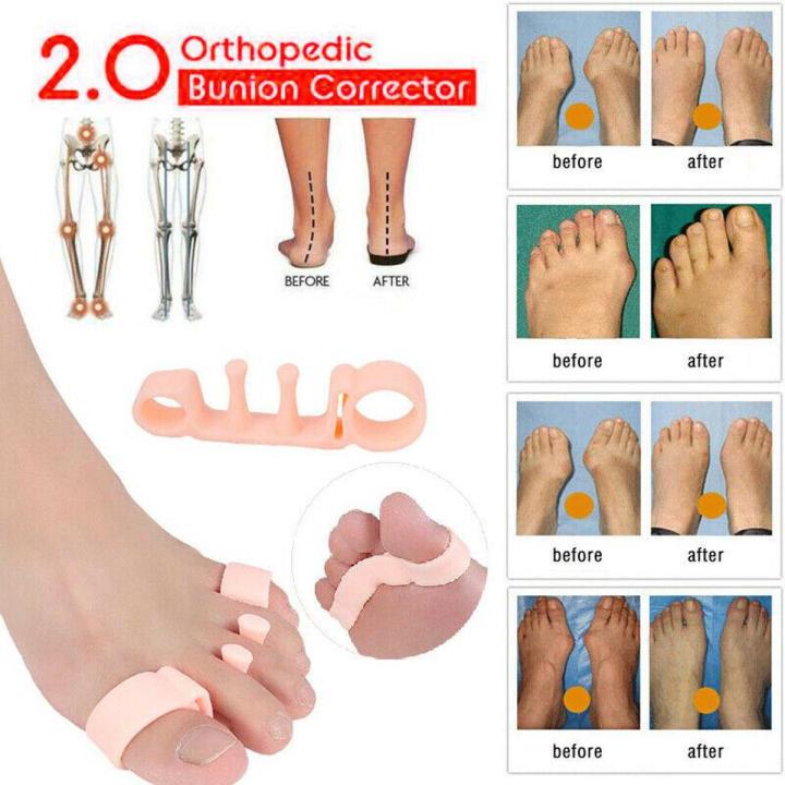 1 Pair Toe Separators Elastic/Silicone Corrector Straightener Toe Spacers Relief
