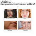 LANBENA 15ml Vitamin C Facial Serum Brighten Freckle Removal Skin Care. 