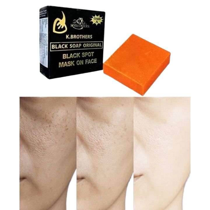 K. Brothers Dark Spot + Acne Soap