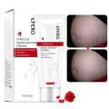 EFERO Repair Cream Removal Scar Stretch Marks Postpartum Maternity Skin Solution. 