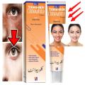 Clobewhite Cream for Freckles and Pigmentation Removal - Achieve Balanced Skin Tone. 