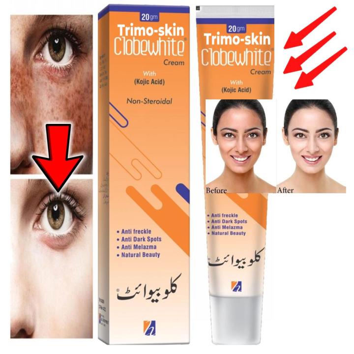 Clobewhite Cream for Freckles and Pigmentation Removal - Achieve Balanced Skin Tone