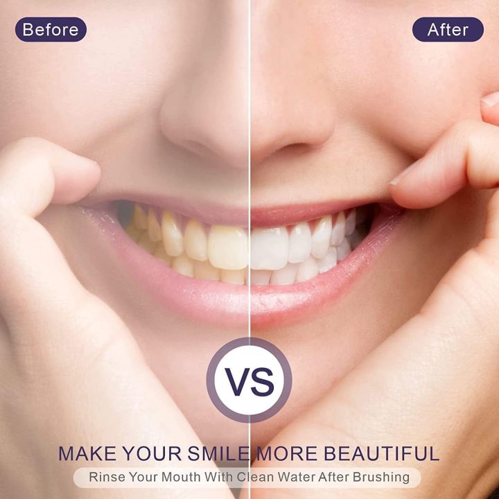 Hismile%20V34%20Purple%20Toothpaste%20%E2%80%93%20Colour%20Corrector%20&%20Teeth%20Whitening%20Booster%20for%20Yellow%20Stains%20(30ml)%20-%20Image%205