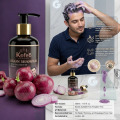 Kofeb London Red Onion Black Seed Oil Moisture Deeply Anti-Hair  Dandruff Shampoo 500ml  For All Hair Loss Prevention Promote Hair Growth. 