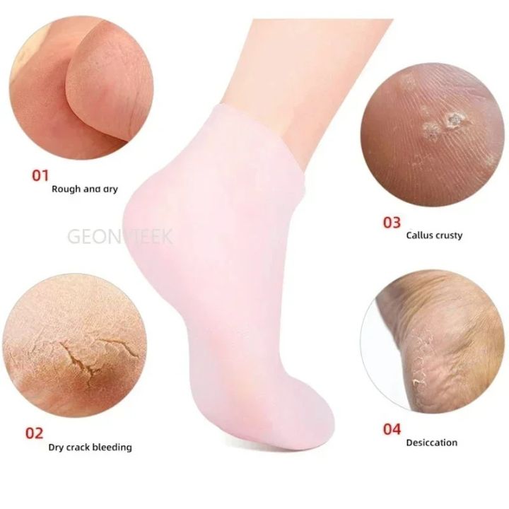 New%20High%20quality%20Unisex%201%20pair%20Silicone%20Moisturizing%20Spa%20Gel%20Heel%20Socks%20Jelly%20Socks%20Foot%20Care%20Socks%20Full%20Heel%20Length%20Foot%20Skin%20Care%20Tools%20Heel%20Pad%20Cracked%20Dead%20Skin%20Remove%20Protector%20Pain%20Relief%20Pedicure%20Tools%20-%20Image%206