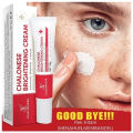 Chalonese Brightening Cream 20g for Acne Marks & Pigmentation | Daily Face Cream for Uneven Skin Tone, Dark Patches & Dullness | Gentle Formula for Smooth, Clear & Radiant Skin. 