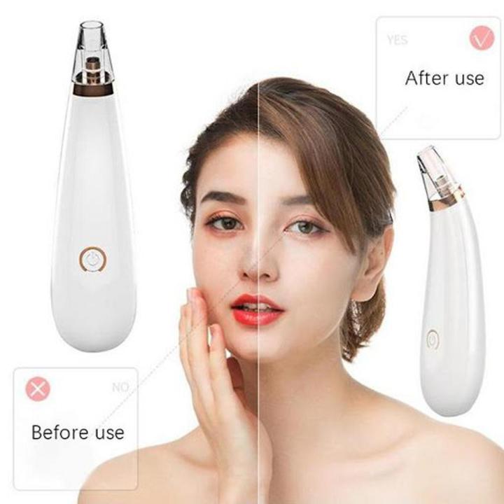 GIVA Blackhead Remover Electric Detector Vacuum Suction Blackhead Acne Extractor Pores Deeply Cleaning Tool Multifunctional Skin Care Beauty Device