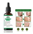 Arfa Cosmetics Salicylic Acid Anti Acne Serum with Salicylic Acid Oil Control and Acne Removal Acne Skin Care Products All Skin Types Use 30Ml. 