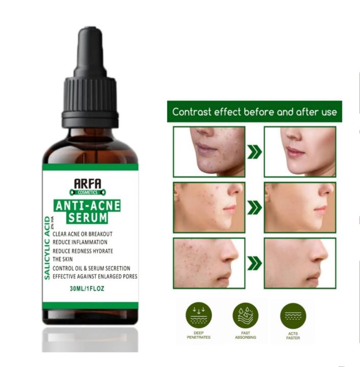 Arfa%20Cosmetics%20Pack%20OF%203%20Whitening%20Serum%20PORE%20REFINING%20Serum%20Niacinamide%20&%20Glycolic%20Acid%20Salicylic%20Acid%20Anti%20Acne%20Serum%20FREE%20DELIVERY%20-%20Image%202