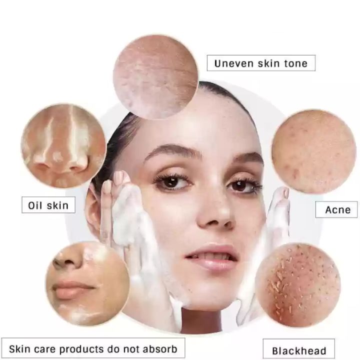 Pack%20of%203%20Trimo%20Skin%20Kojic%20Acid%20Skin%20Repair%20Cream%20Anti-Dark%20Spot%20Fade%20Cream,%20for%20all%20Skin%20Types%20-%20Image%204